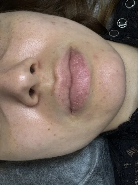 Micropigmentação labial vista de lado, Kaoma Ferraz, Alvalade, Lisboa
